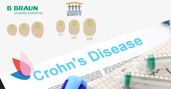 Η νόσος του Κρον: Αίτια, Στατιστικές, Συμπτώματα, Διατροφή &#038; Σακούλες Στομίας