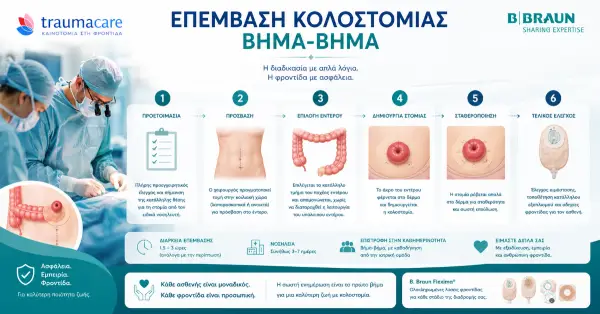 Chirurgie de la colostomie : ce que vous devez savoir