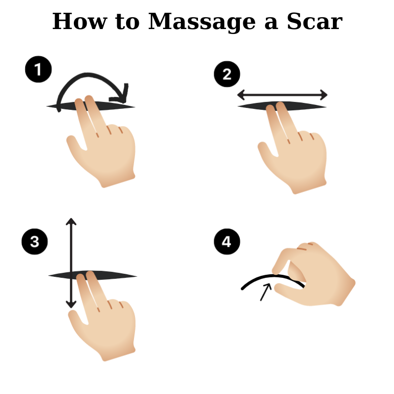 The picture indicates how to massage a scar