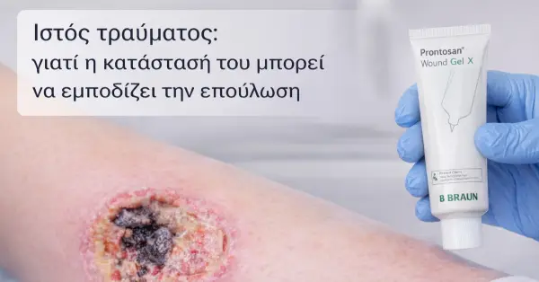 Ιστός τραύματος: γιατί η κατάστασή του μπορεί να εμποδίζει την επούλωση