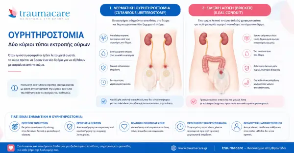 Кога се извършва уретеростомия — Показания и последни международни препоръки