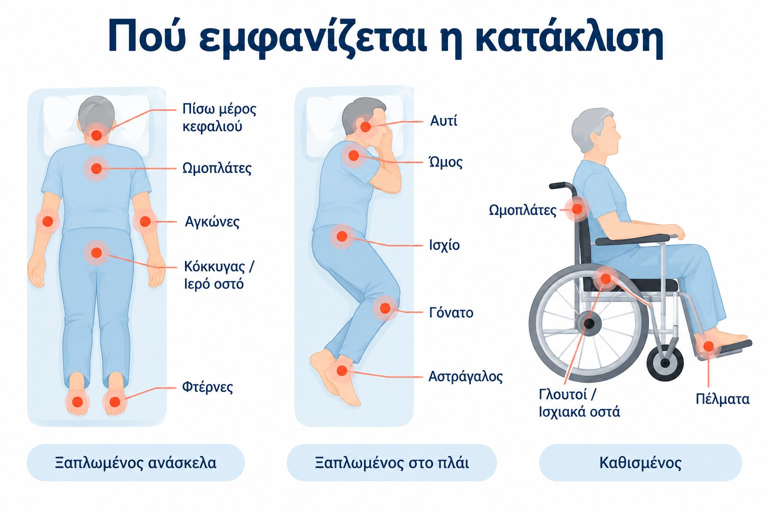 Πού εμφανίζεται η κατάκλιση: σημεία κινδύνου ξαπλωμένος ανάσκελα, στο πλάι και καθιστός σε αμαξίδιο