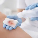 Wound Cleanser